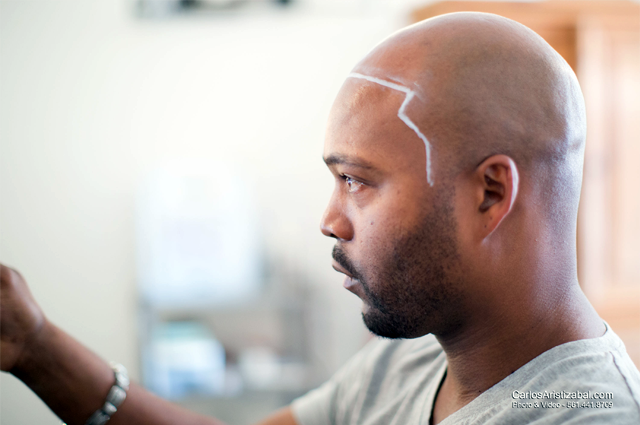 Scalp Micropigmentation Certification