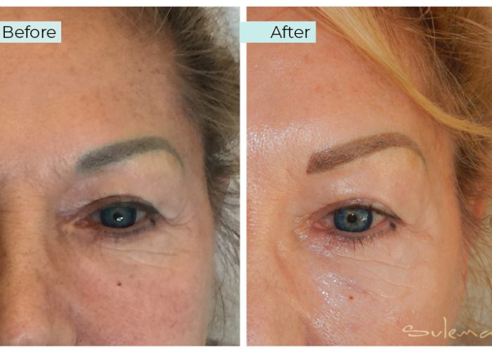 Eyebrow Color Correction